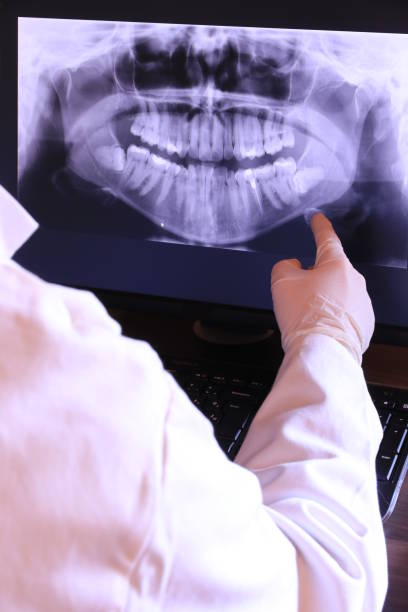 Best Emergency Dental Care for Broken or Chipped Teeth in Chipley, FL